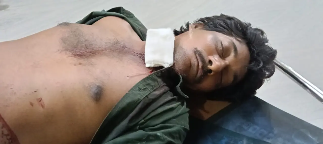 पत्नी ने किया पति पर चाकू से वार