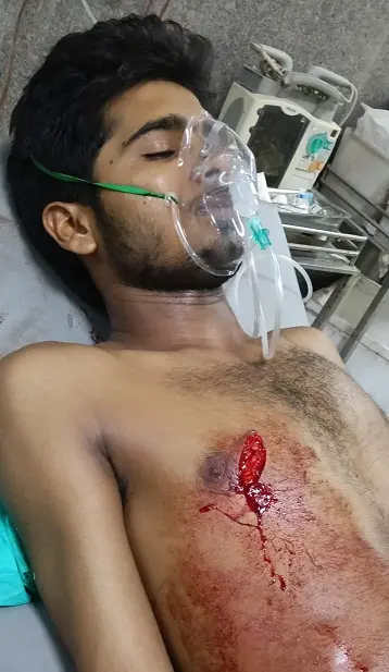शहर में फिर चाकूबाजी,युवक पर चाकुओं से हमला