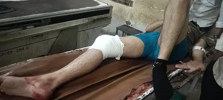 मुक्ता प्रसाद थाना इलाके में युवक पर फायरिंग